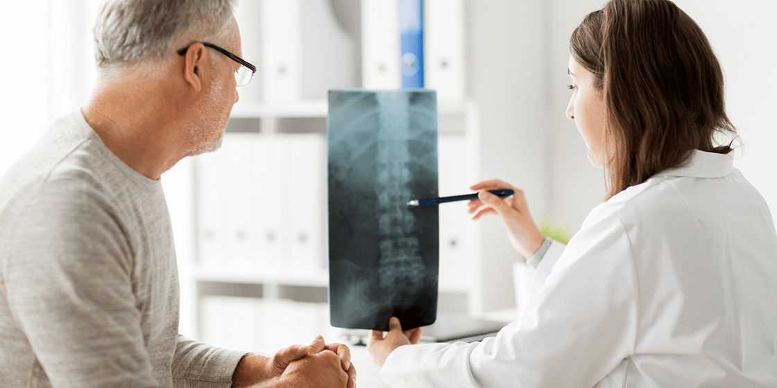 پزشک متخصص طب فیزیکی و توانبخشی در حال بررسی عکس رادیولوژی